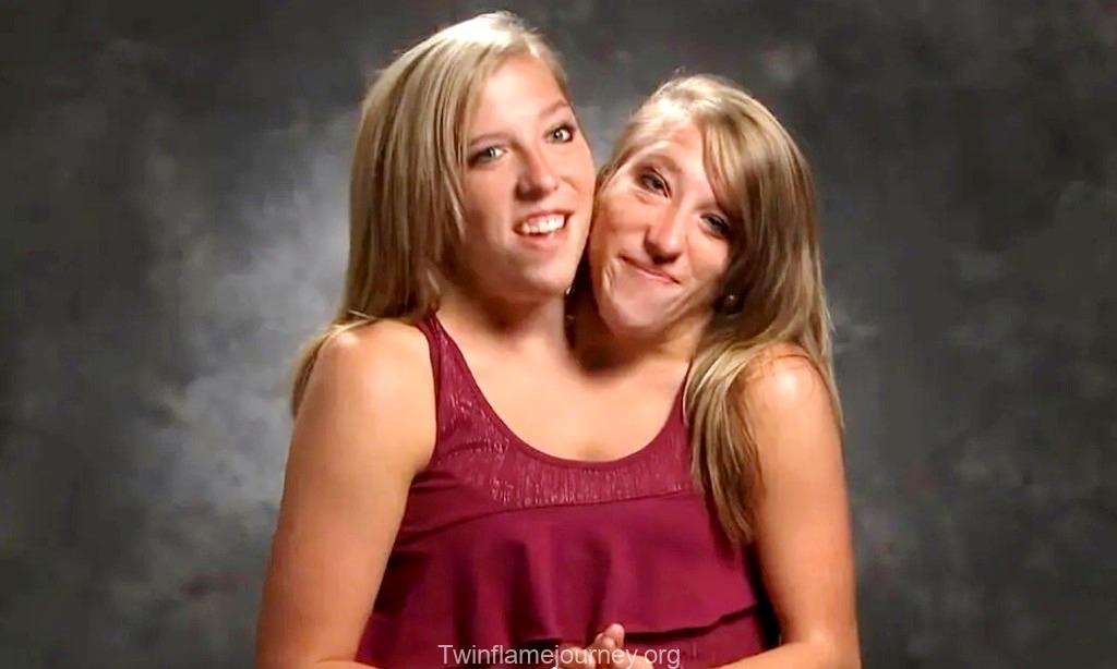 Abby and Brittany Hensel - Wikipedia
